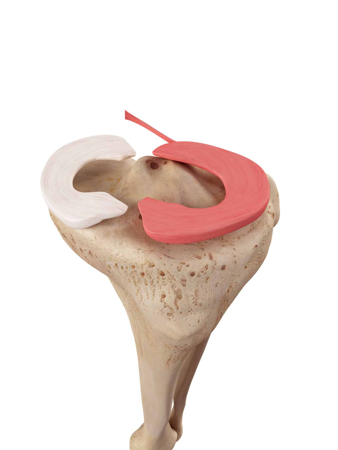 Meniskusläsion FußschmerzLexikon