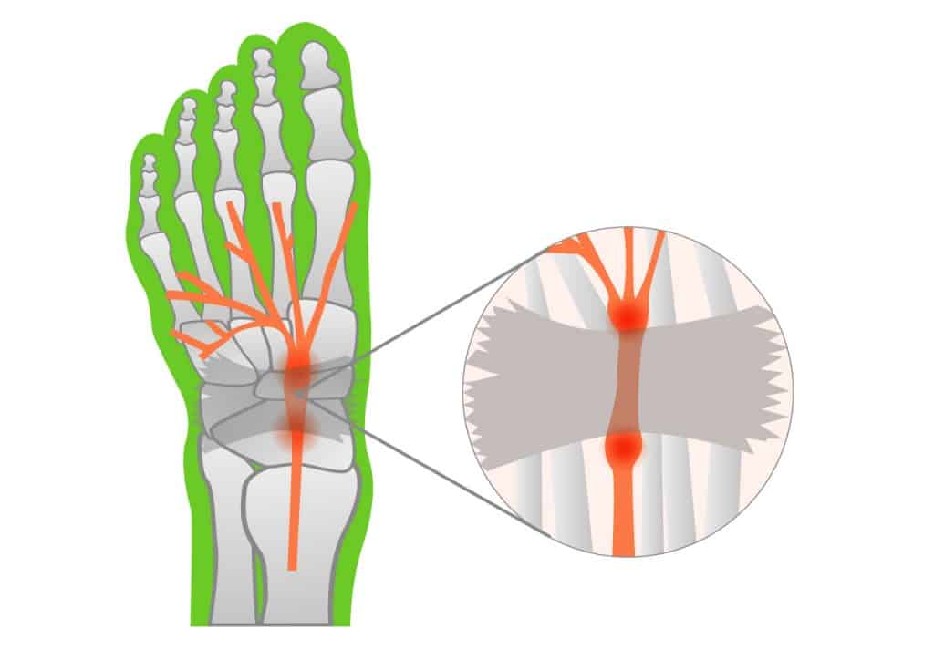 Illustration der Nerven in einem Fuß