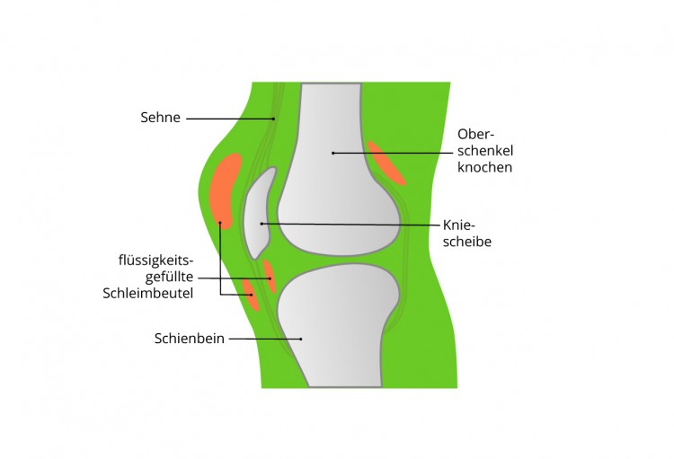 Wo Sitzen Schleimbeutel Im Fuß www.fussschmerz-ratgeber.de