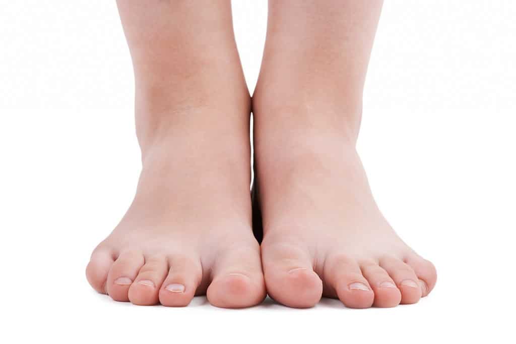 Füße mit der Fußfehlstellung Spreizfuß
